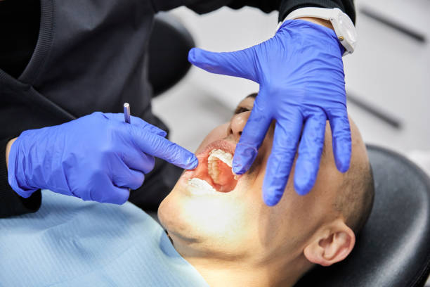 Best Dentist for Tooth Abscess  in Lake Royale, NC